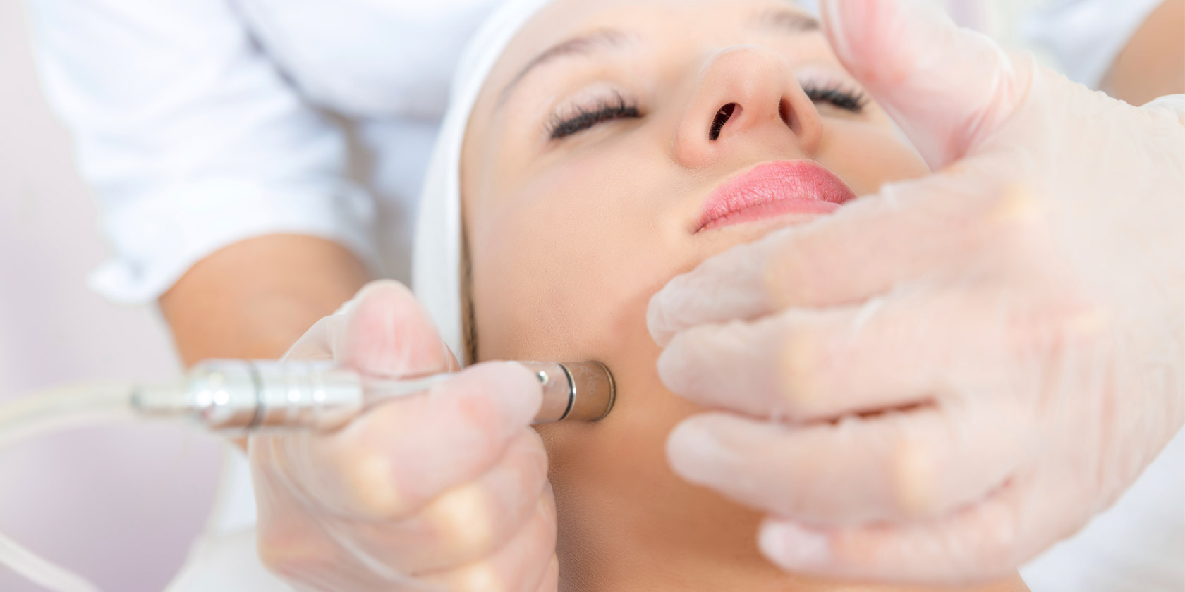 Monteil Microdermabrasion Fur Zuhause