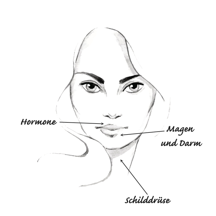 zeichnung eines weiblichen gesichts mit pfeilen, die auf regionen mit pickeln und deren ursachen hinweisen