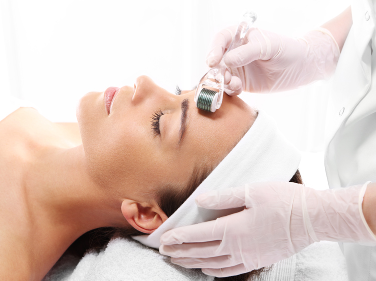 micro needling